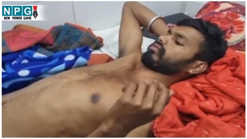 Bilaspur News: कुत्ते ने बुजुर्ग और बच्ची को काटा, समझाइश देने पर कुत्ते के मालिक ने युवक पर चाकू से किया हमला…