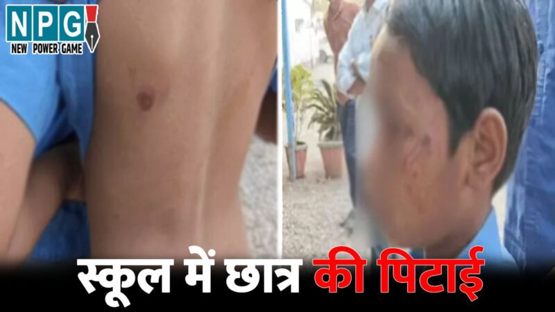 Dhamtari News: स्कूल में छात्र की पिटाई, दीवार फांदकर घुसा सनकी, मासूम को डंडे से पीटकर जमीन पर घसीटा