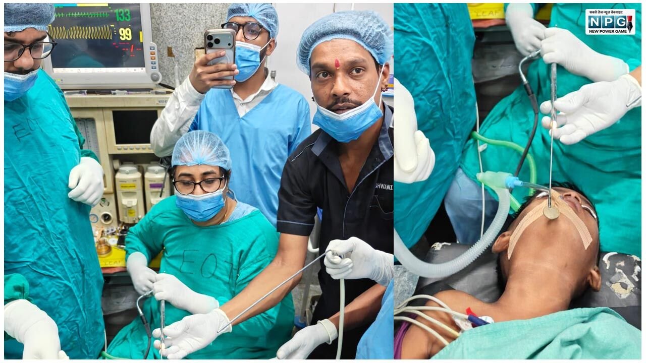 CG News: खेलते-खेलते बच्चे ने 5 रुपये का सिक्का निगल लिया, गले में जाकर फंस गया, CIMS के डॉक्टर्स ने बचाई जान